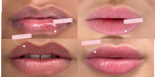 Lips Semi-Permanent Makeup