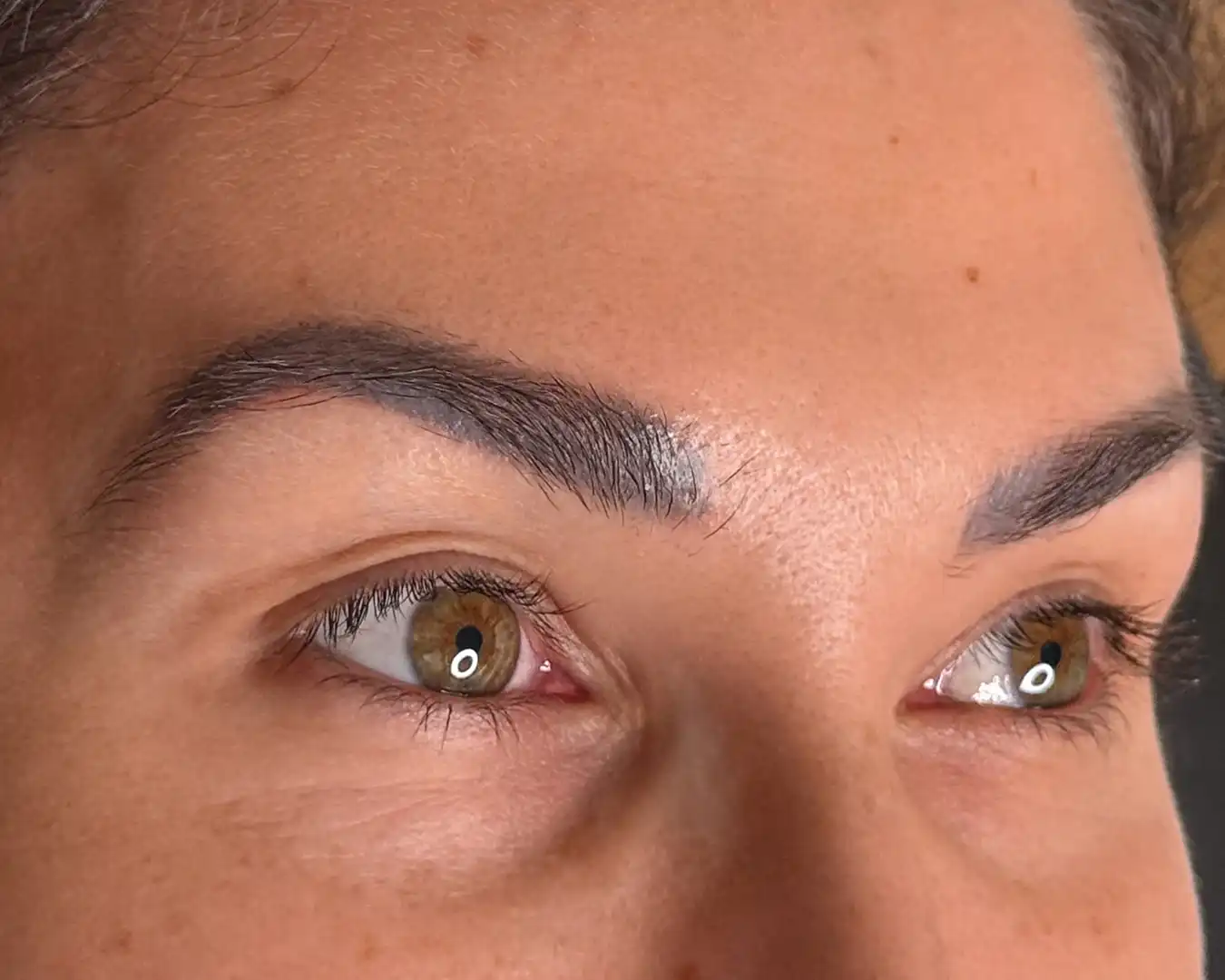 Tattoo removal before treatment